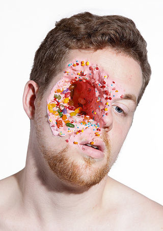 Illustration for article titled Gruesome injuries recreated with candy and ice cream are pure nightmare fuel